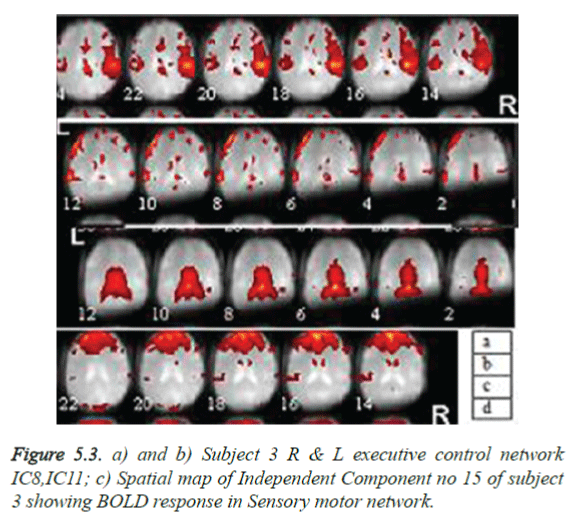 biomedres-BOLD-response-Sensory-motor-network