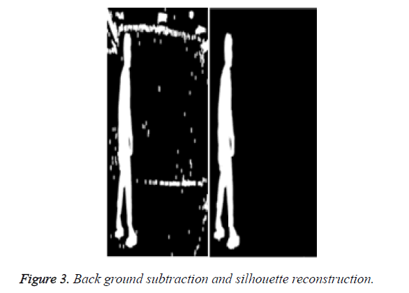 biomedres-Back-ground-subtraction