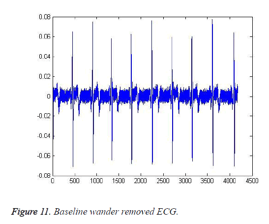 biomedres-Baseline-wander