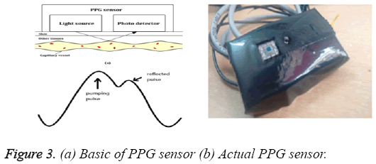 biomedres-Basic-PPG-sensor