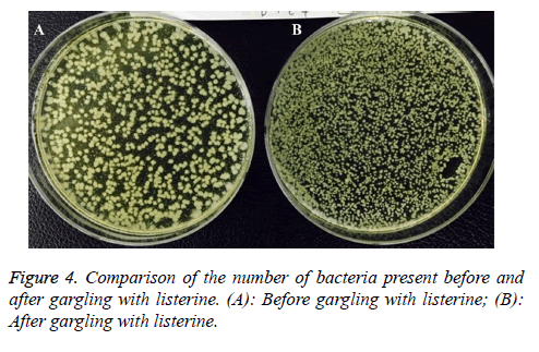 biomedres-Before-gargling