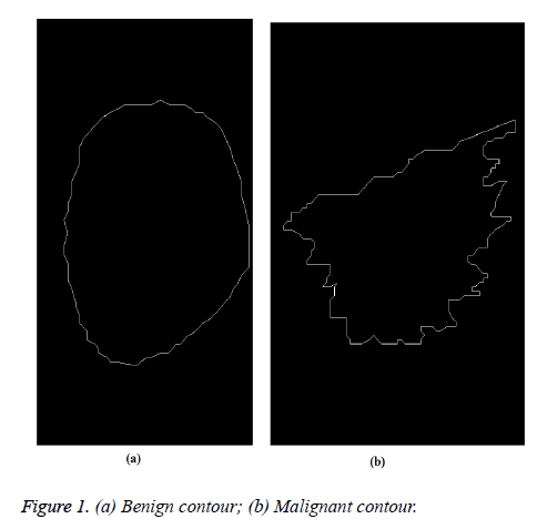 biomedres-Benign-contour