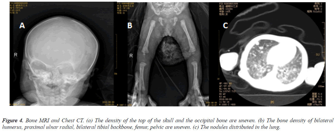 biomedres-Bone-MRI-Chest