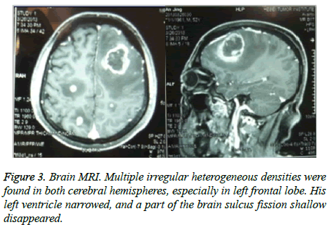 biomedres-Brain-MRI