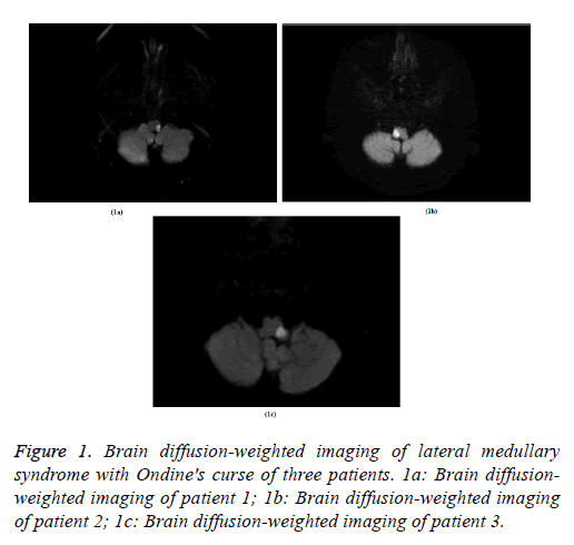 biomedres-Brain-diffusion