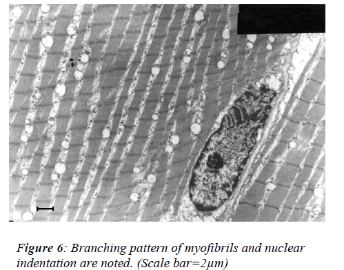 biomedres-Branching-pattern-myofibrils