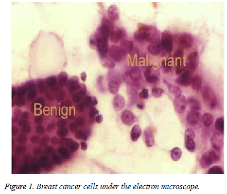 biomedres-Breast-cancer