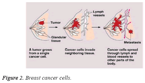 biomedres-Breast-cancer-cells