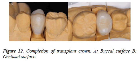 biomedres-Buccal-surface