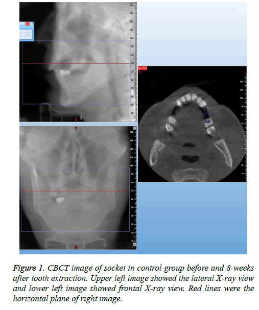 biomedres-CBCT-image