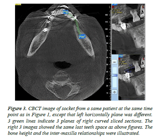 biomedres-CBCT-image