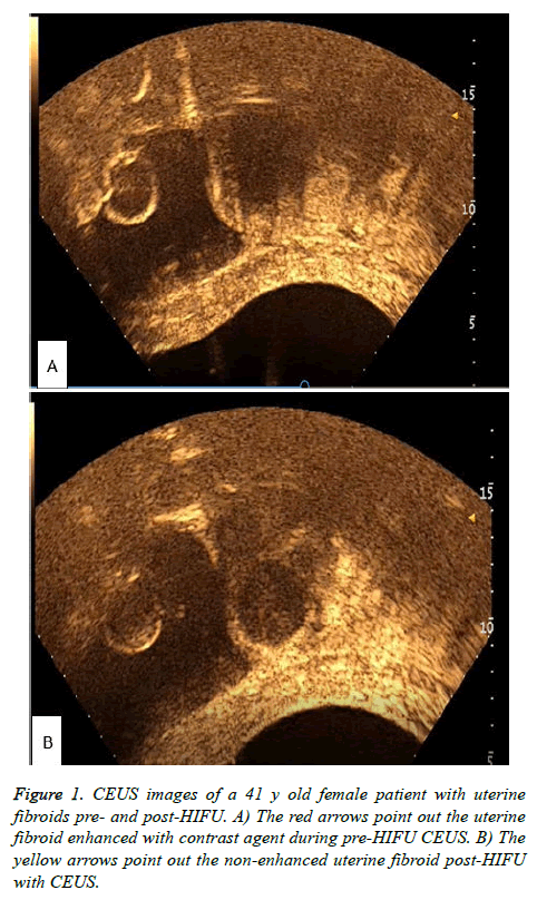 biomedres-CEUS-images