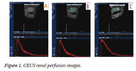 biomedres-CEUS-renal