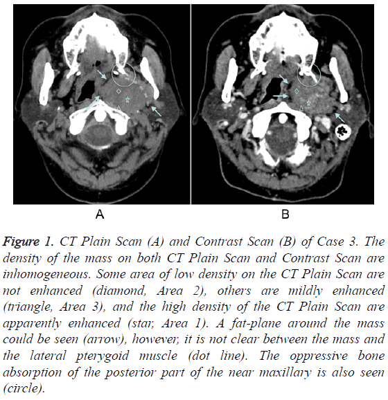 biomedres-CT-Plain-Scan