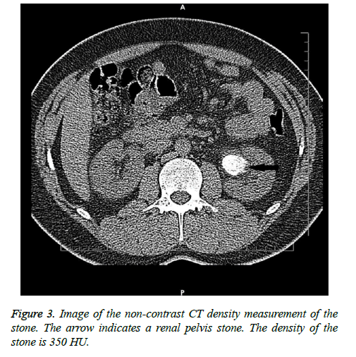 biomedres-CT-density