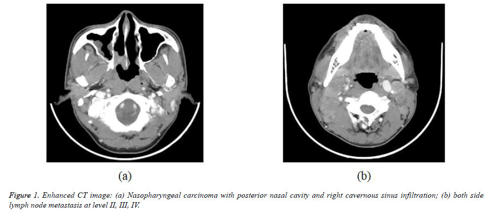 biomedres-CT-image