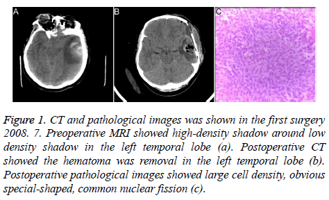 biomedres-CT-pathological