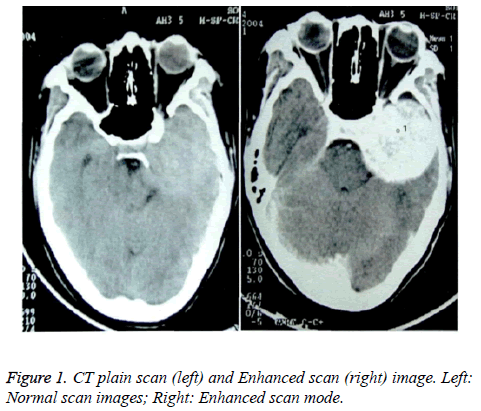 biomedres-CT-plain