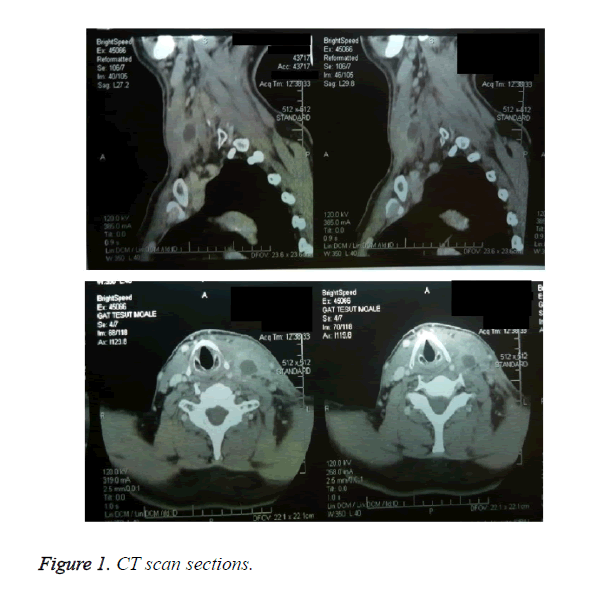 biomedres-CT-scan-sections