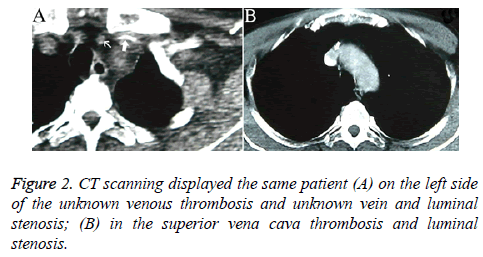 biomedres-CT-scanning