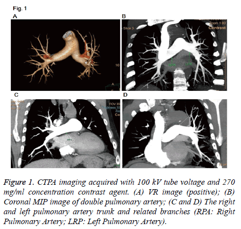 biomedres-CTPA-imaging