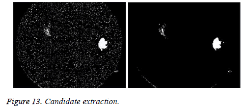 biomedres-Candidate-extraction