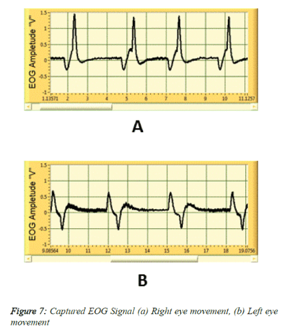 biomedres-Captured-EOG-Signal