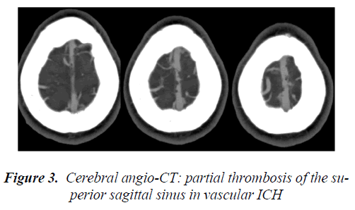 biomedres-Cerebral-angio