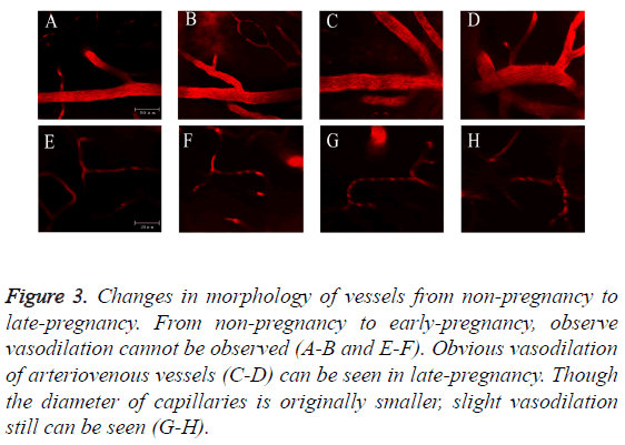 biomedres-Changes-morphology-vessels