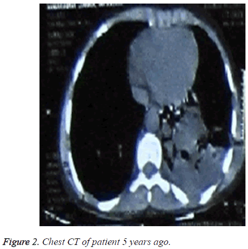 biomedres-Chest-CT-patient