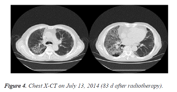 biomedres-Chest-X-CT