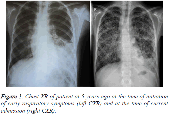 biomedres-Chest-XR-patient