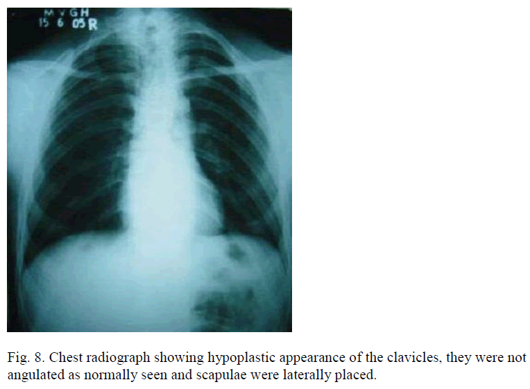 biomedres-Chest-radiograph