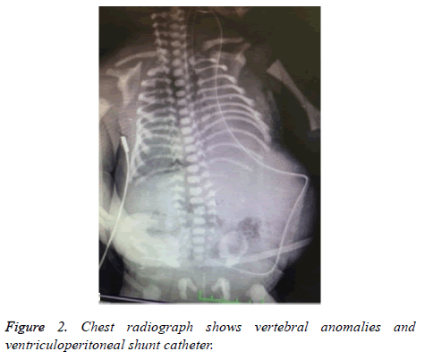 biomedres-Chest-radiograph