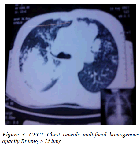 biomedres-Chest-reveals