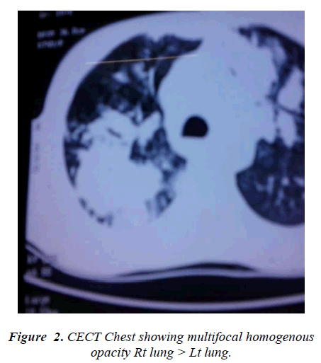 biomedres-Chest-showing