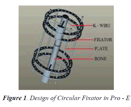 biomedres-Circular-Fixator