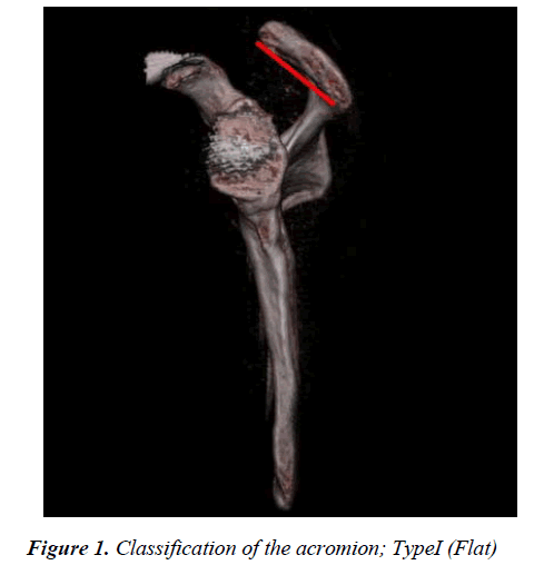 biomedres-Classification-acromion