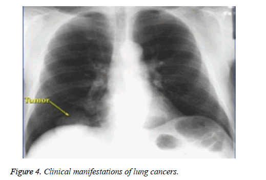 biomedres-Clinical-manifestations