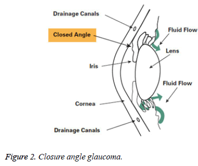 biomedres-Closure-angle