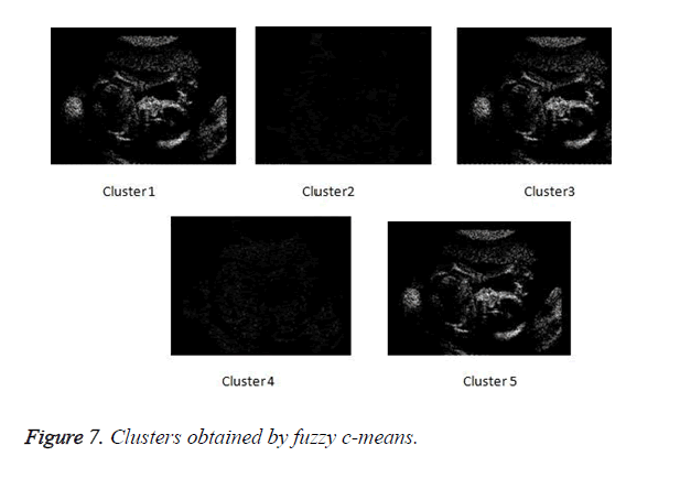biomedres-Clusters-obtained-fuzzy