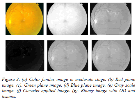 biomedres-Color-fundus-image