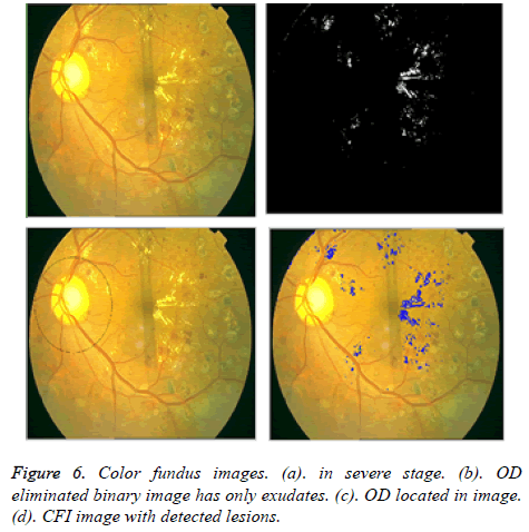 biomedres-Color-fundus-images