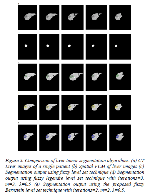 biomedres-Comparison-liver