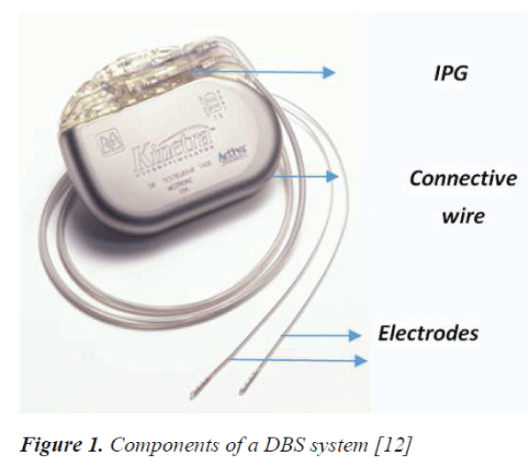 biomedres-Components-DBS-system