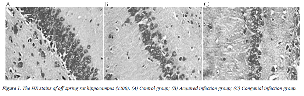 biomedres-Congenial-infection