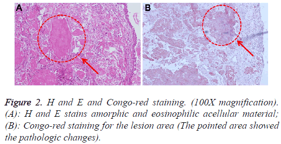 biomedres-Congo-red-staining