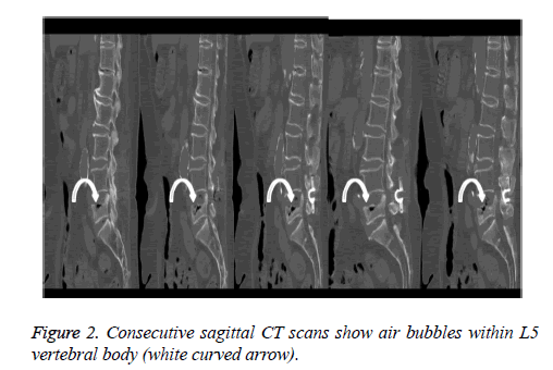 biomedres-Consecutive-sagittal