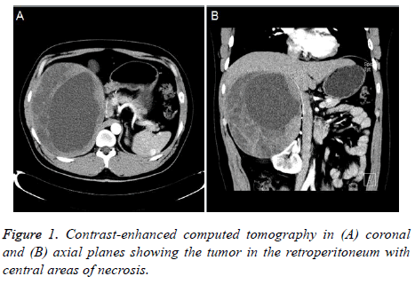 biomedres-Contrast-enhanced