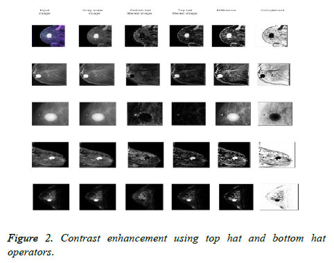 biomedres-Contrast-enhancement